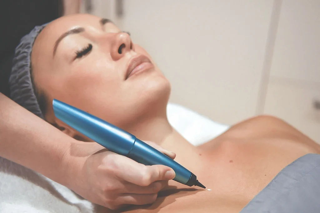 What is CryoPen Technology Welwyn-Garden-City? Welwyn-Garden-City