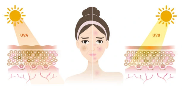 Understanding Sun Damage Welwyn-Garden-City : How Do UV Rays Cause Changes in the Skin? Welwyn-Garden-City